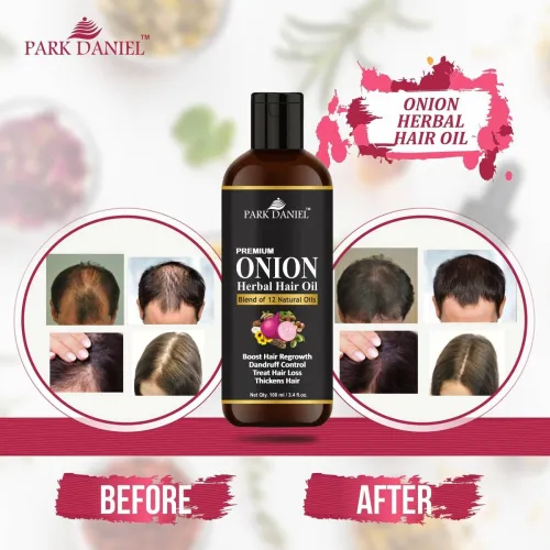 Image of PARK DANIEL ONION Herbal Hair oil